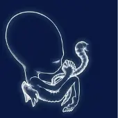 Warner Ada Agaetis Byrjun