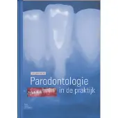Bohn Stafleu van Loghum Parodontologie in de Praktijk (Hardback)