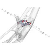 Lapierre Spicy T Schoklink