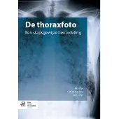 Bohn Stafleu van Loghum De thoraxfoto (Paperback)