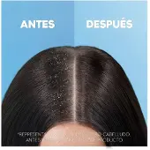 Head & shoulders 2-in-1 Klassieke Shampoo 1000ml
