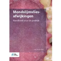 Springer Media B.V. Mondslijmvliesafwijkingen
