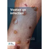 Springer Media B.V. Voeten en infecties