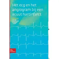 Springer Media B.V. Het ECG en het angiogram bij een acuut hartinfarct