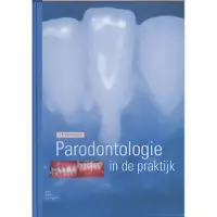 Bohn Stafleu van Loghum Parodontologie in de Praktijk (Hardback)