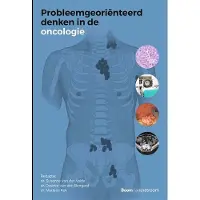 BOOM Probleemgeoriënteerd denken in de oncologie (Paperback)