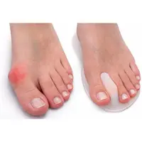 Uriel - Teenspreider - Hallux valgus - Voorvoetkussen - Gel - Drukverlichting - 1 paar